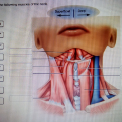 Correctly muscles posterior label following